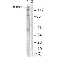 Rabbit Polyclonal Antibody to c-Met (Ab-1003)