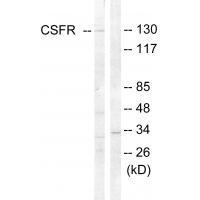 Rabbit Polyclonal Antibody to CSFR (Ab-809)