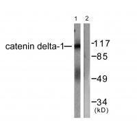 Rabbit Polyclonal Antibody to Catenin-δ1 (Ab-228)
