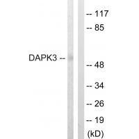 Rabbit Polyclonal Antibody to DAPK3 (Ab-265)