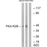 Rabbit Polyclonal Antibody to PKA-R2β (Ab-113)