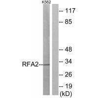 Rabbit Polyclonal Antibody to RFA2 (Ab-21)