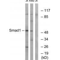 Rabbit Polyclonal Antibody to Smad1 (Ab-187)
