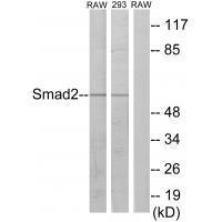 Rabbit Polyclonal Antibody to Smad2 (Ab-220)