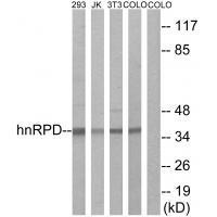 Rabbit Polyclonal Antibody to hnRPD (Ab-83)