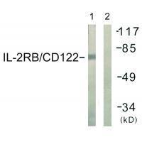 Rabbit Polyclonal Antibody to IL-2Rβ/CD122 (Ab-364)