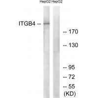 Rabbit Polyclonal Antibody to ITGB4 (Ab-1510)