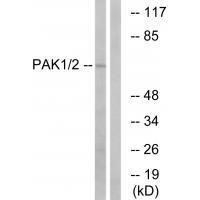 Rabbit Polyclonal Antibody to PAK1/2 (Ab-199)
