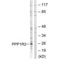Rabbit Polyclonal Antibody to PPP1R2 (Ab-120/121)