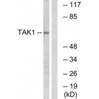Rabbit Polyclonal Antibody to TAK1 (Ab-184)