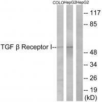 Rabbit Polyclonal Antibody to TGF β Receptor I (Ab-165)