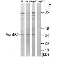 Rabbit Polyclonal Antibody to AurB/C (Ab-202/175)