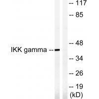 Rabbit Polyclonal Antibody to IKK-γ (Ab-85)