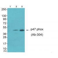 Rabbit Polyclonal Antibody to Neutrophil Cytosol Factor 1 (Ab-304)