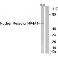 Rabbit Polyclonal Antibody to Nuclear Receptor NR4A1 (Ab-351)