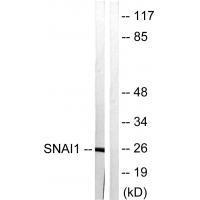 Rabbit Polyclonal Antibody to SNAI1 (Ab-246)