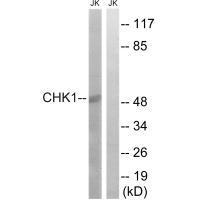 Rabbit Polyclonal Antibody to Chk1 (Ab-280)