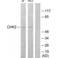 Rabbit Polyclonal Antibody to Chk2 (Ab-68)