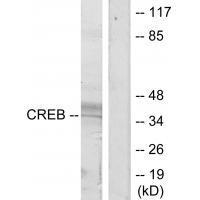 Rabbit Polyclonal Antibody to CREB (Ab-129/133)