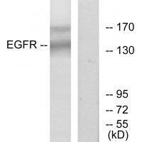 Rabbit Polyclonal Antibody to EGFR (Ab-1172)
