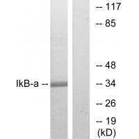 Rabbit Polyclonal Antibody to IκB-α (Ab-32/36)