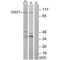 Rabbit Polyclonal Antibody to VAV1 (Ab-174)