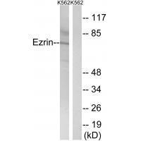Rabbit Polyclonal Antibody to Ezrin (Ab-478)