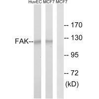 Rabbit Polyclonal Antibody to FAK (Ab-843)