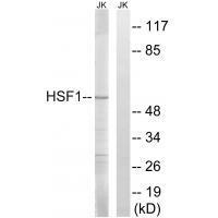 Rabbit Polyclonal Antibody to HSF1 (Ab-121)