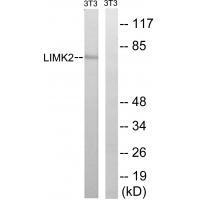 Rabbit Polyclonal Antibody to LIMK2 (Ab-283)