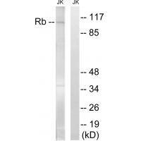 Rabbit Polyclonal Antibody to Retinoblastoma (Ab-608)