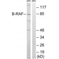 Rabbit Polyclonal Antibody to B-RAF (Ab-446)