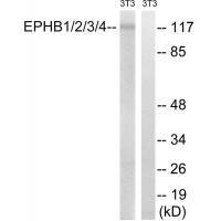 Rabbit Polyclonal Antibody to EPHB1/2/3/4 (Ab-600/602/614/596)