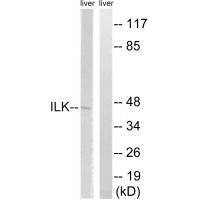 Rabbit Polyclonal Antibody to ILK (Ab-246)