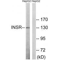 Rabbit Polyclonal Antibody to INSR (Ab-1375)