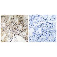 Rabbit Polyclonal Antibody to LATS1/2