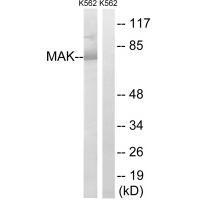 Rabbit Polyclonal Antibody to MAK (Ab-159)