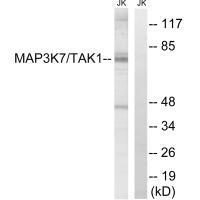 Rabbit Polyclonal Antibody to MAP3K7 (Ab-187)