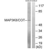 Rabbit Polyclonal Antibody to MAP3K8 (Ab-400)