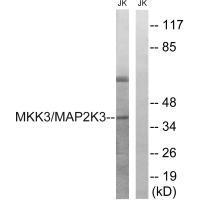 Rabbit Polyclonal Antibody to MAP2K3 (Ab-222)