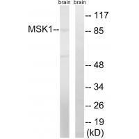 Rabbit Polyclonal Antibody to MSK1 (Ab-212)