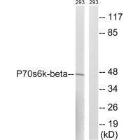 Rabbit Polyclonal Antibody to p7S6 Kinase β (Ab-423)