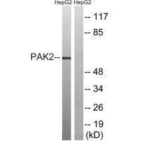Rabbit Polyclonal Antibody to PAK2 (Ab-192)