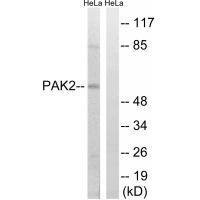 Rabbit Polyclonal Antibody to PAK2 (Ab-141)