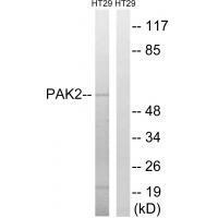 Rabbit Polyclonal Antibody to PAK2 (Ab-197)
