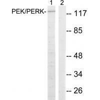 Rabbit Polyclonal Antibody to PEK/PERK (Ab-981)