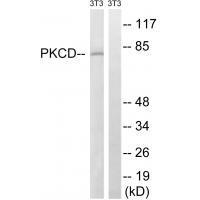Rabbit Polyclonal Antibody to PKCD (Ab-64)