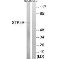 Rabbit Polyclonal Antibody to STK39 (Ab-325)