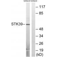 Rabbit Polyclonal Antibody to STK39 (Ab-311)