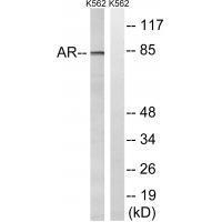 Rabbit Polyclonal Antibody to Androgen Receptor (Ab-363)